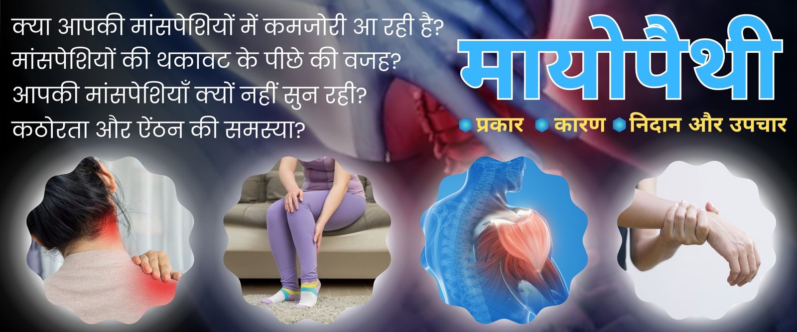 Minepathy मायोपैथी-मांसपेशी रोग (Myopathy - Muscle Disease) - न्यूरोज्ञान